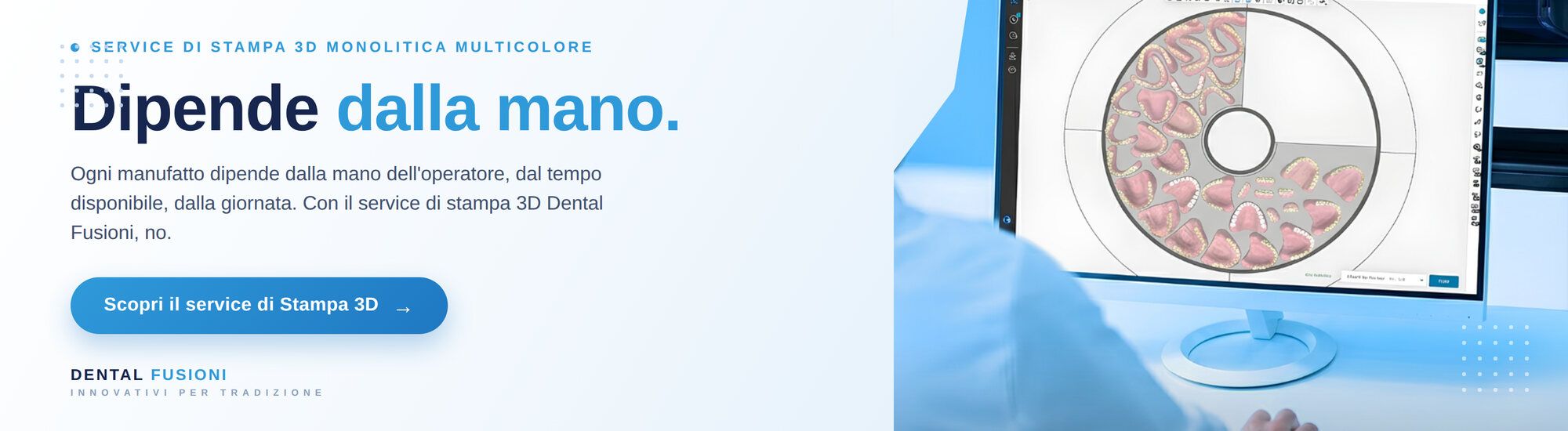 Service di stampa 3D monolitica multicolore - Dental Fusioni